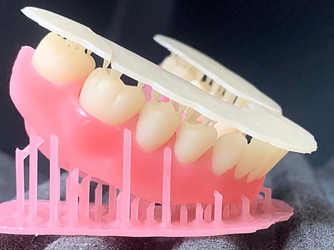 Фото стоматологии «Зуботехническая лаборатория, CAD/CAM» - Напечатанные конструкции на 3D-принтере