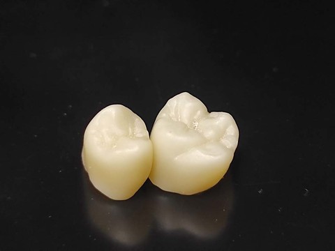 Фото стоматологии «Зуботехническая лаборатория, CAD/CAM» - Циркониевые коронки после синтеризации